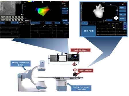 APN Health, Navik 3D cardiac mapping system, FDA clearance