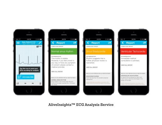 cardiac diagnostics software mobile devices ecg monitoring services alivecor