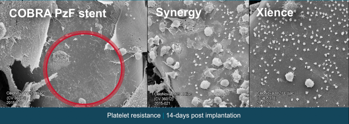 CeloNova Cobra Pzf stent, stent strut platelet resistentance 