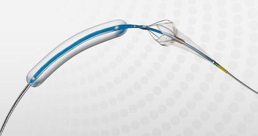 Contego Medical Receives CE Mark for Vanguard IEP Peripheral Balloon Angioplasty System