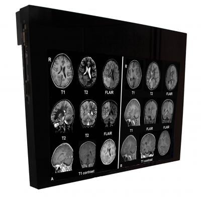 Flat Panel Displays, RSNA 2014, MRI Systems, DBI24-MRSafe