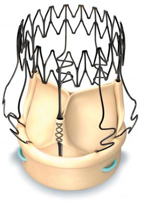 CMS Awards New Technology Add-on Payment for Perceval Sutureless Aortic Heart Valve