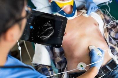 ASE, Echovation Challenge 2017, cardiovascular ultrasound, echocardiography, innovation