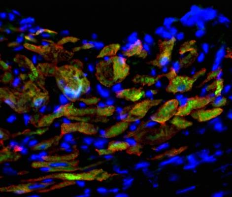 cardiac progenitor cells, UW-Madison study, mouse fibroblasts