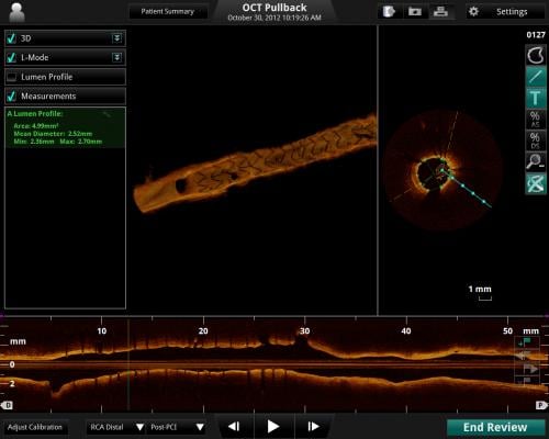 OCT st. jude imaging systems cath lab advanced visualization ilumiens
