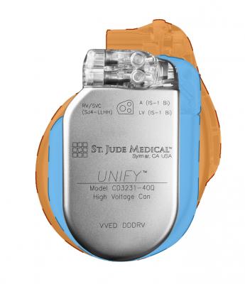 Ce mark St Jude Medical Assura Fortify ICD Unify CRT-D Quadra CRT-D