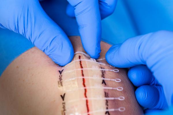 Zip medical hotsell