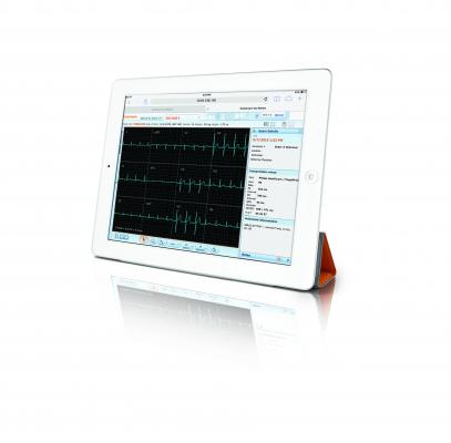 Carestream, Vue Motion universal viewer, ECG waveforms, diagnostic reading, FDA clearance