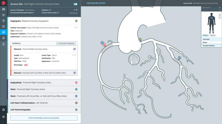 ZHealth Launches Etch Cardiovascular Coding Software
