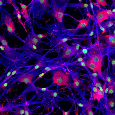 Elisa Avolio, newborn heart cells, BHF, Reflections of Research image competition, U.K.