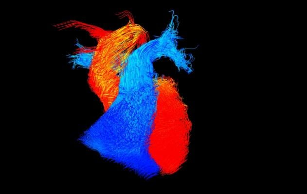 BHF, Reflections of Research image competition, U.K., 4-D MRI, heart blood flow