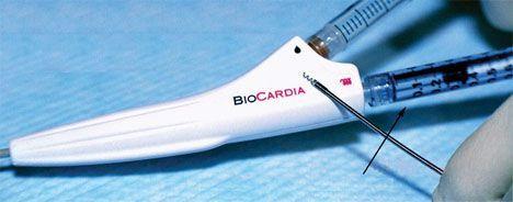 BioCardia Helix Catheter