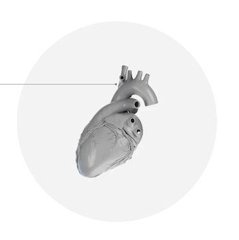Circle Cardiovascular Releases Latest Version of Unified Cardiac Imaging Platform