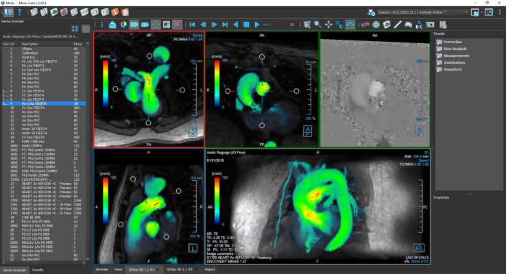 Tech tools are creating positive change in Cardiac MRI Software Market