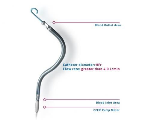 The components of the Abiomed Impella RP catheter used for right heart hemodynamic support.