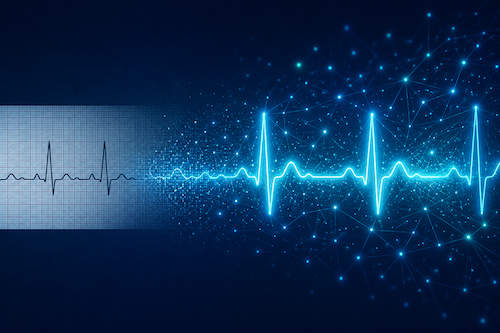 Turning ECG Data into Actionable Insight with AI
