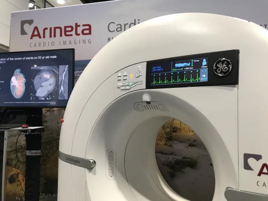 Arineta created a dedicated cardiac CT scanner in partnership with GE Healthcare a couple years ago. With increased interest in CTA with the new chest pain guidelines, the company decided to also start direct sales of these systems for the first time at RSNA in their own booth. Photos by Dave Fornell