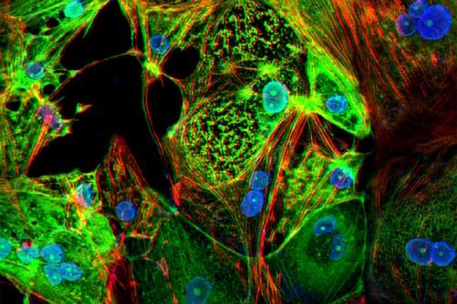 A study from Washington University School of Medicine in St. Louis provides evidence that the coronavirus can invade and replicate inside heart muscle cells, causing cell death and interfering with heart muscle contraction. The image of engineered heart tissue shows human heart muscle cells (red) infected with COVID-19 (SARS-CoV-2) (green). Image by Lina Greenberg.