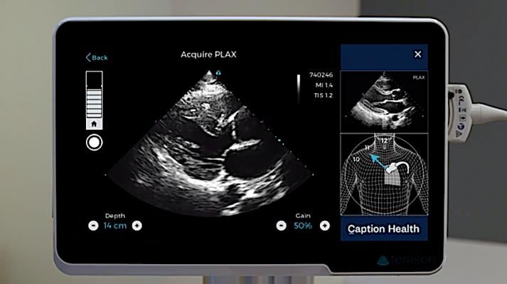 The artificial intelligence-driven Caption Guidance software guides point of care ultrasound (POCUS) users to get optimal cardiac ultrasound images. The AI software is an example of a FDA-cleared software that is helping improve imaging, even when used by less experienced users.