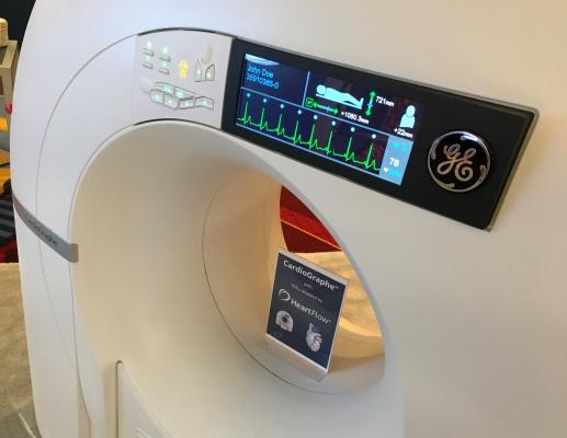 The GE healthcare Cardiographe is a compact CT scanner designed for office or small space installation. It is a dedicated cardiac CT scanner. #SCCT19