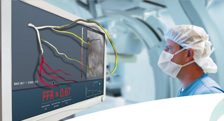 In December 2018, the FDA cleared CathWorks' FFRangio System. It derives the FFR numbers from routine X-rays acquired during a diagnostic fluoroscopic angiogram procedure. It is performed intra-procedurally during a coronary angiography, eliminating additional time and costs associated with invasive FFR. The system provides a 3-D reconstruction of the entire coronary tree with FFR values along each vessel.