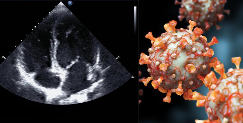 The American Society of Echocardiography (ASE) has issued a statement on how centers may consider to reopen cardiac ultrasound services as hospitals begin resuming elective procedures and tests amid the COVID-19 (SARS-CoV-2) pandemic. #COVID19 #SARScov2 #ASE