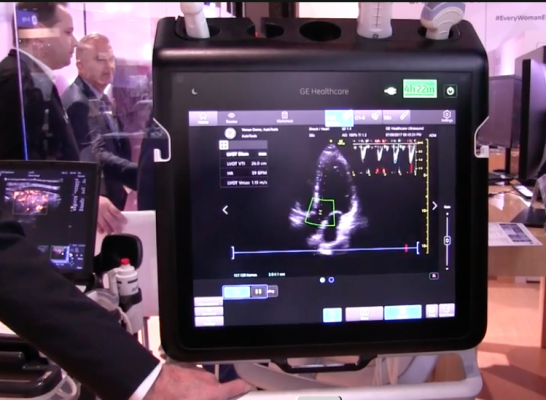 GE Healthcare rolled out its first implementation of AI in its ultrasound systems, starting with its new point-of-care Venue system. RSNA 2017, #RSNA2017, #RSNA17