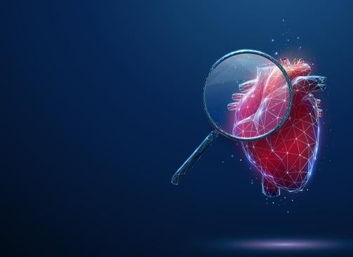 IVUS, cardiac imaging