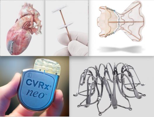 Some of the new devices technologies to treat heart failure that are either in clinical trials or were recently cleared by the U.S. FDA. #heartfailure