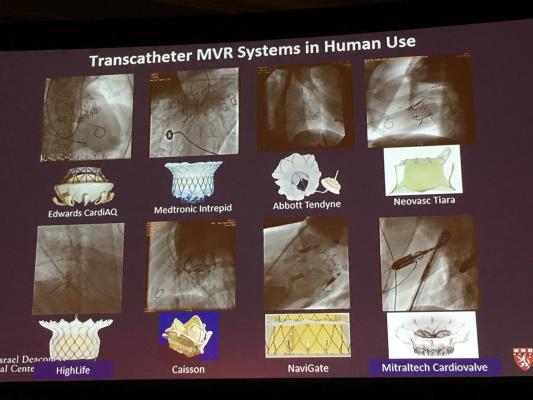A sample of the transcatheter mitral valve replacement (TMVR) devices in development or clinical trials.