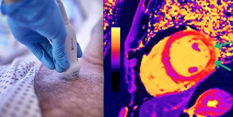 Among the top stories from December 2021 was new ultrasound transducer technology introduction by Philips Healthcare and the use of cardiac MRI to assess myocarditis caused by COVID-19 vaccinations.