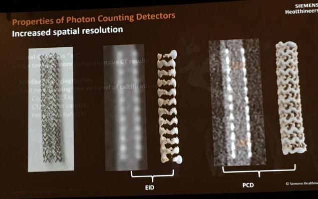 Example of how the photon-counting CT detector being developed by Siemens can improve the resolution of a coronary stent. #SCCT19