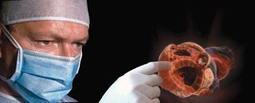 RealView's 3-D holographic projection of a heart 
