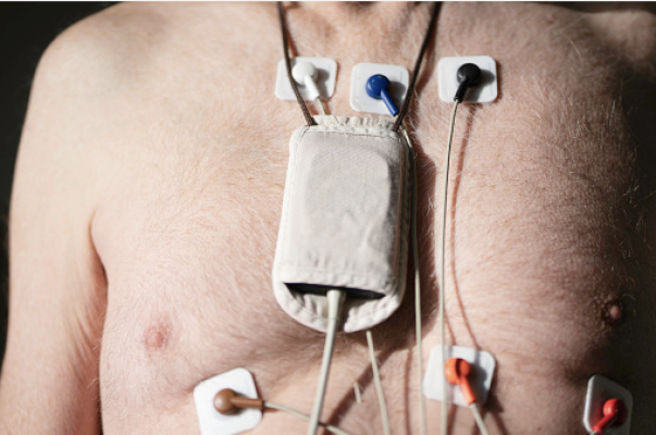 Holter monitors are firmly ensconced as the standard device for remote cardiac monitoring. 