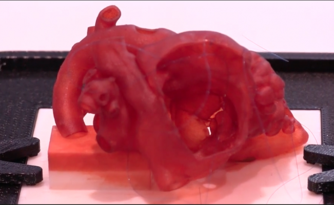 Stratasys introduced its Biomimics product. It combines several existing 3-D printing materials with new software that allows users to create custom, life-like anatomy that mimics the physical traits of actual tissues. RSNA 2017, #RSNA2017, #RSNA17