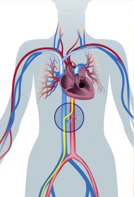 An illustration showing the transcaval access cross over point between the venous and arterial systems. 