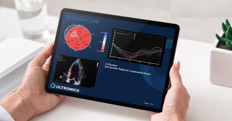 The WASE-COVID Study used the artificial intelligence automated echocardiogram reading software EchoGo-Core from Ultromics to evaluate ejection fraction and left ventricle longitudinal strain in COVID-19 patients to identify risk markers for mortality. The study also compared human vs. AI variability in assessing the exams. #ACC21 #ACC2021