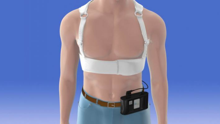 The Zoll LifeVest wearable defibrillator system was evaluated in the late-breaking VEST Trial presented at ACC 2018 earlier this year. A review article on the results was the No. 1 most viewed article in July and August. 