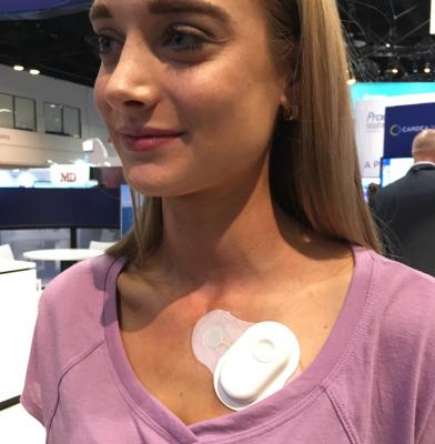 Wearable ecg heart monitor clearance
