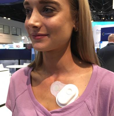 This is the Cardea Solo wearable ECG monitor. It uses a retrievable data pod that stores all data for the time the patient wears the device. The outside case is disposable. 