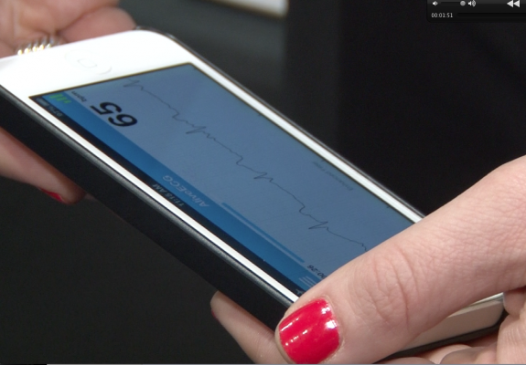 AliveCor enables a single-lead ECG recordings on a smartphone that can be immediately shared with physician, or scanned by an app to determine if there is an abnormality. These types of devices serve as a basis for mobile healthcare on demand.