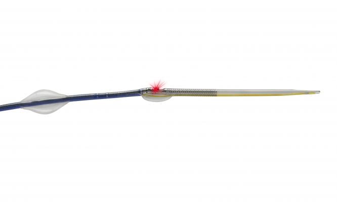 The Avinger Pantheris atherectomy device, which incorporates OCT intravascular imaging.