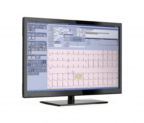 GE Healthcare released Version 9 of its Muse ECG management system at ACC.16. This latest version allows connectivity with non-GE ECG systems, including newer, wearable ECG monitors. GE Muse, ecg management system