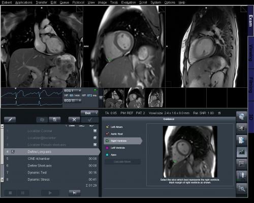 An example of Siemens' MRI DOT Cardiac Engine software.