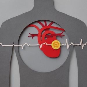 MRI, cardiac imaging, AI