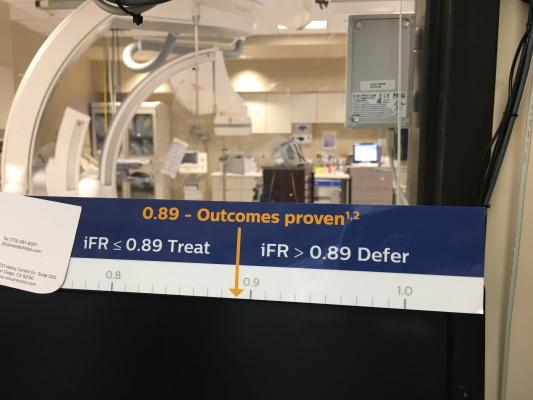 The ORBITA Trial showed FFR and iFR are good predictors of PCI outcomes. This was a 2018 PCR late-breaker.