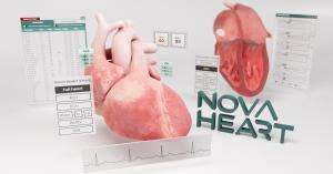 Nova Heart creates a dynamic, 3D digital twin of a patient’s heart using 2D transthoracic echocardiogram data. 