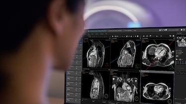 Philips, SmartHeart, cardiac MRI