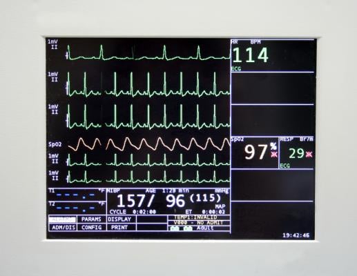 Cerner, Mortara, CareAware Waveform Management, ECG, monitoring, cardiac PACS