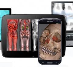 Advanced visualization, RSNA 2014, Remote viewing systems, mobile devices